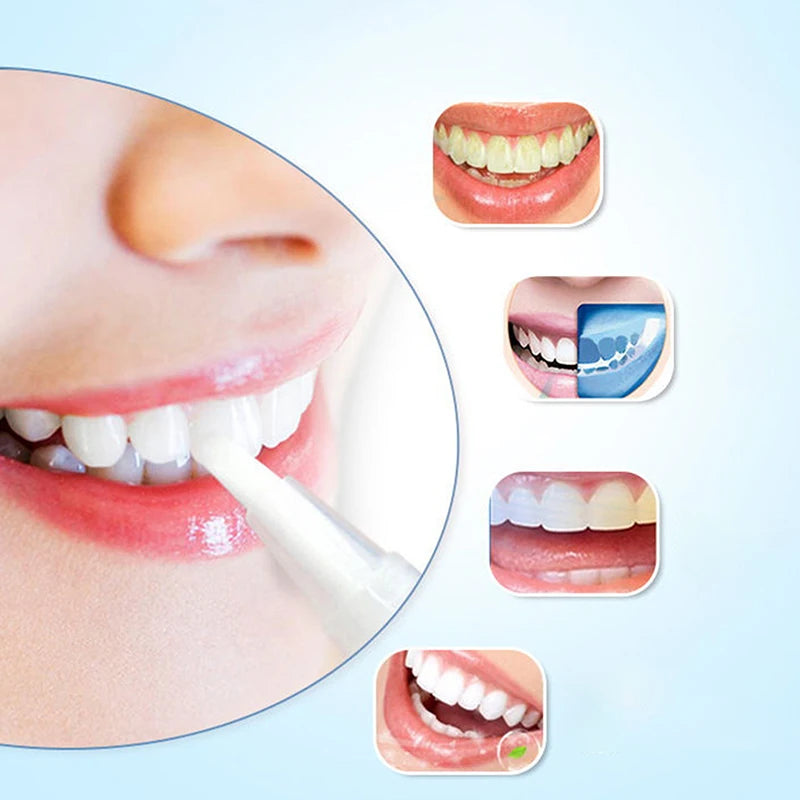 3Pcs Purple Teeth Whitening Pen Instant Stain Tartar Removal Toothpaste Oral Hygiene No Sensitivity Whitening Tool Set