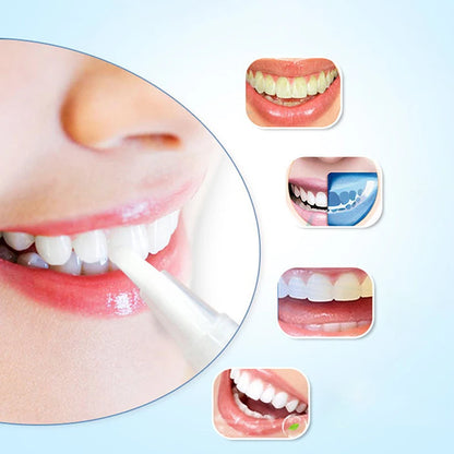 3Pcs Purple Teeth Whitening Pen Instant Stain Tartar Removal Toothpaste Oral Hygiene No Sensitivity Whitening Tool Set