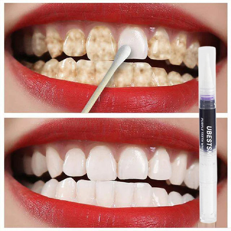 3Pcs Purple Teeth Whitening Pen Instant Stain Tartar Removal Toothpaste Oral Hygiene No Sensitivity Whitening Tool Set