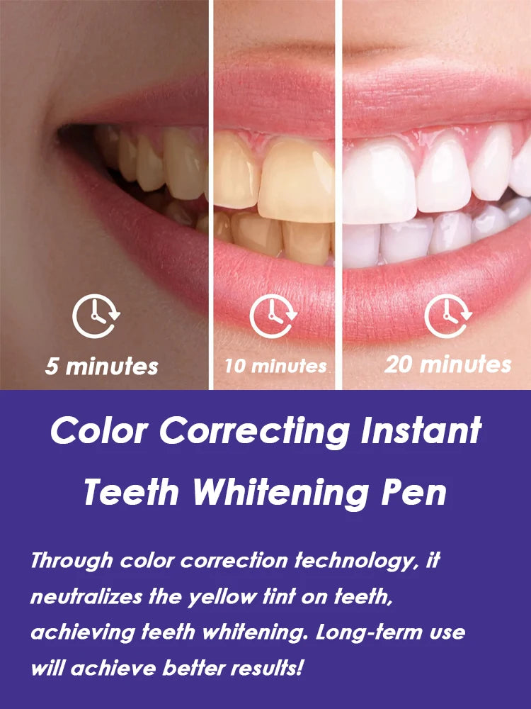 GlorySmile™ Teeth Whitening Pen